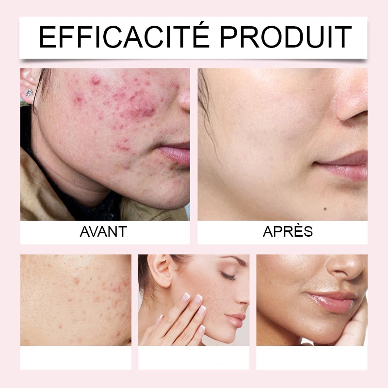 Tampons nettoyants et exfoliant à l'Acide Kojique et au Curcuma