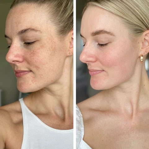 Tampons nettoyants et exfoliant à l'Acide Kojique et au Curcuma